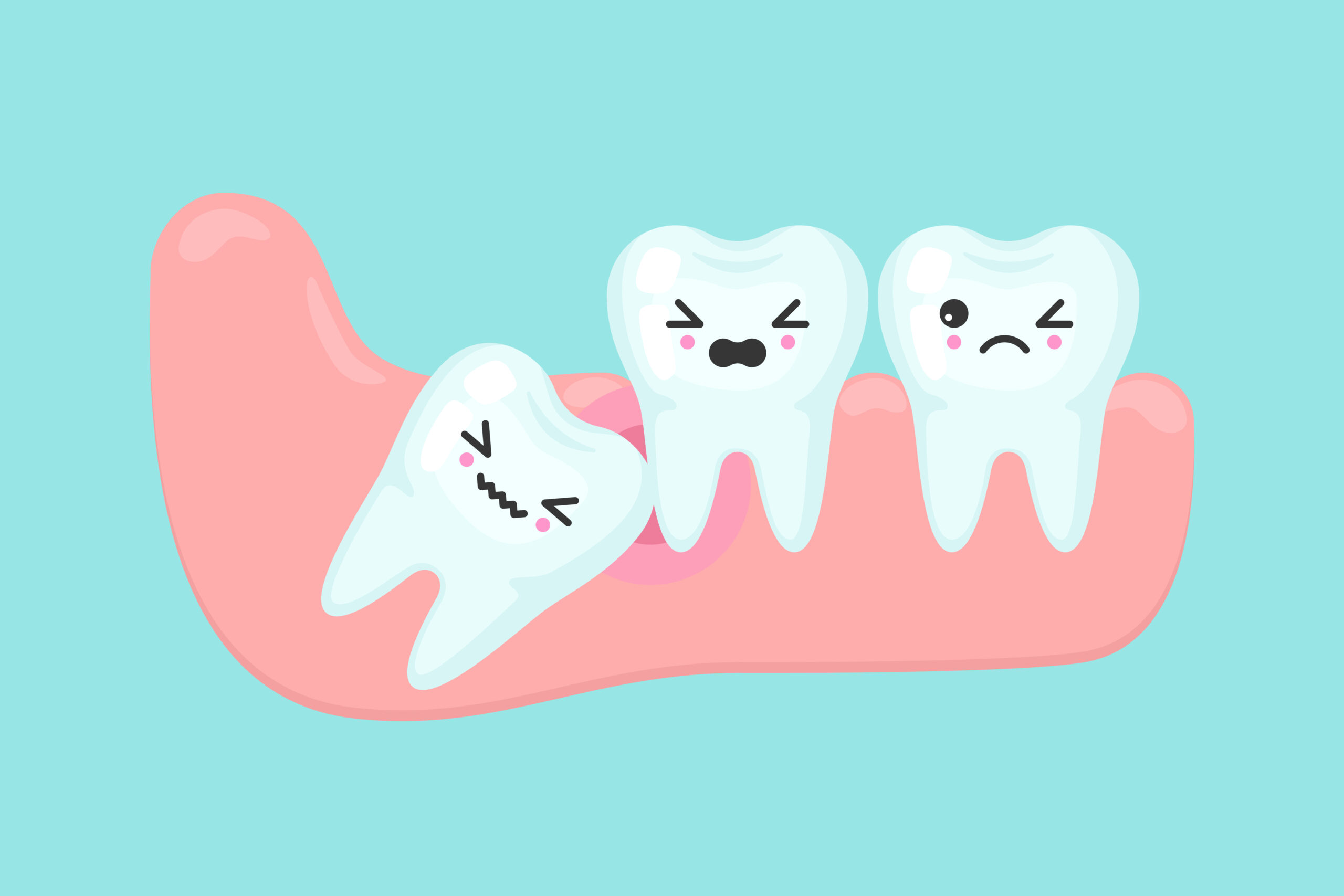 Wisdom Teeth Removal: What to Expect After Surgery