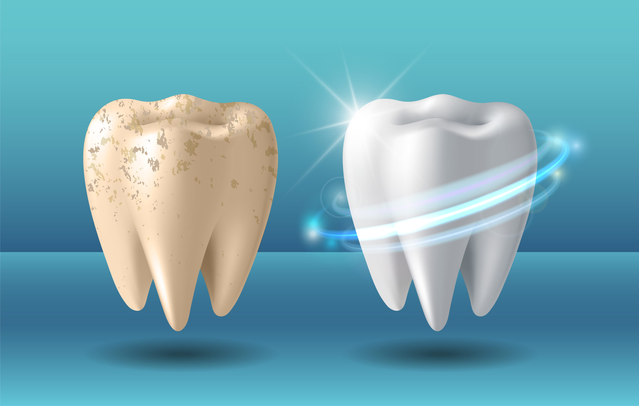 Illuminate Your Smile: Advanced Teeth Whitening Solutions